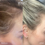 Revive 7 Revitalizing Hair Treatment