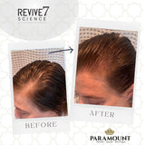 Revive 7 Revitalizing Hair Treatment