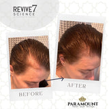 Revive 7 Revitalizing Hair Treatment